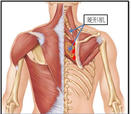 長期肩頸痠痛或是肩胛骨痛？那你一定要知道什麼是「膏肓痛」｜桃園物理治療