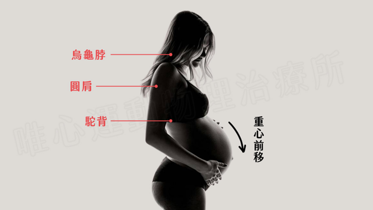 產後體態問題示意圖-唯心物理治療所