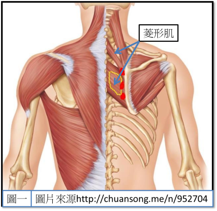 為什麼我的膏肓一直痛？| 姿勢矯正,桃園姿勢矯正