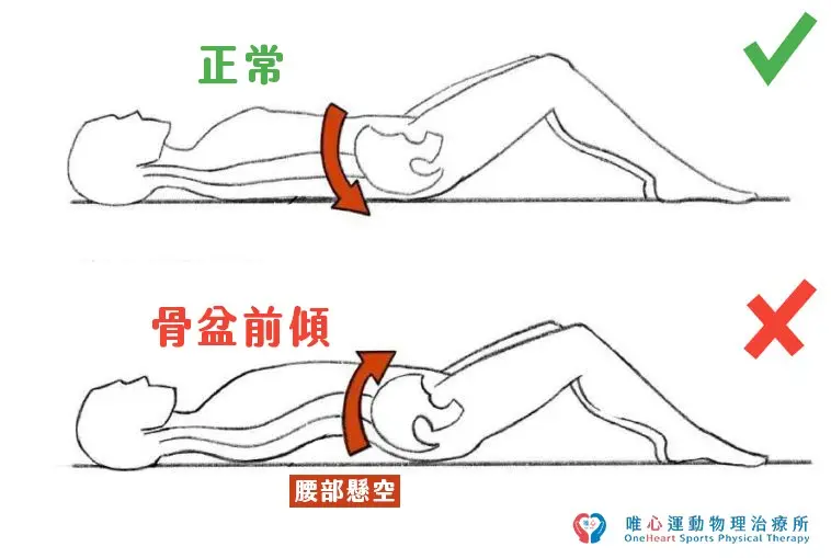 唯心運動醫療體系:解析骨盆前傾與床墊支撐力的關聯,預防起床腰部緊縮痠痛