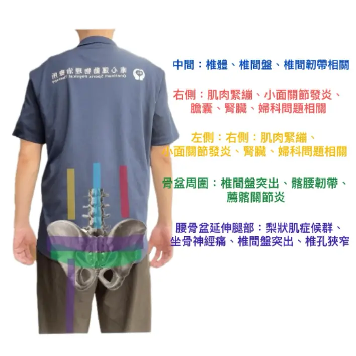 唯心運動醫療體系:物理治療師製作下背痛位置對照表圖表,提供民眾進行初步簡易自我檢測