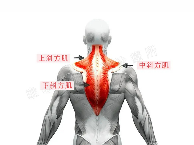 唯心運動醫療體系：物理治療師解說上斜方肌緊繃與周邊肌肉結構失衡引起的肩頸痠痛僵硬症狀
