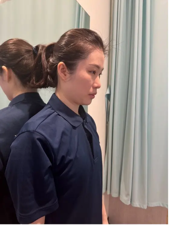 矯正富貴包前後差異對比圖