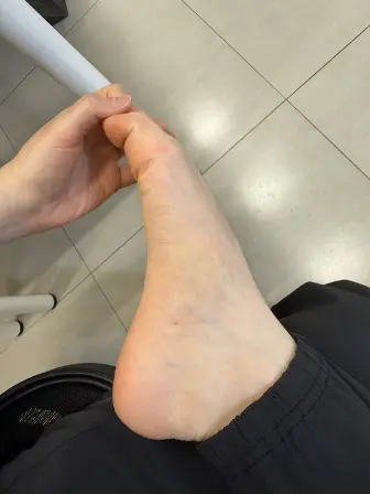 唯心運動醫療體系：物理治療師示範腳背痛舒緩方式：坐姿腳趾伸展